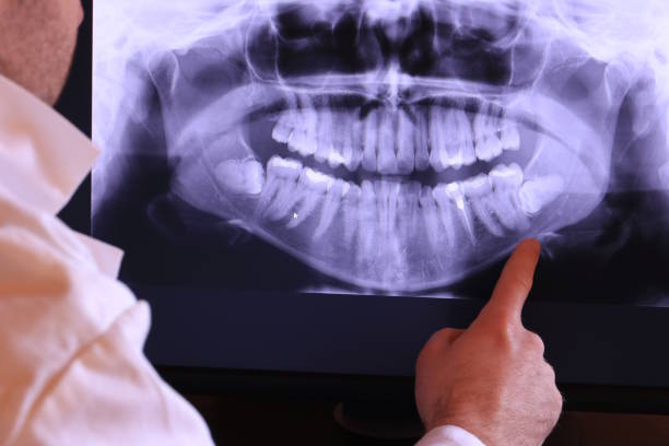 Tooth Infection Emergency Dentist in CO