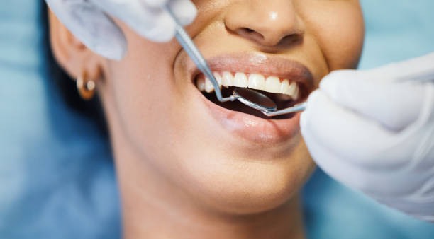 Best Dentist for Tooth Abscess  in Cascade Chipita Park, CO